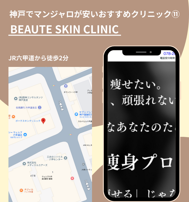 神戸でマンジャロが安いクリニック　