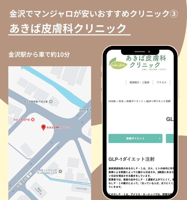 金沢でマンジャロが安いおすすめクリニック③あきば皮膚科クリニック
