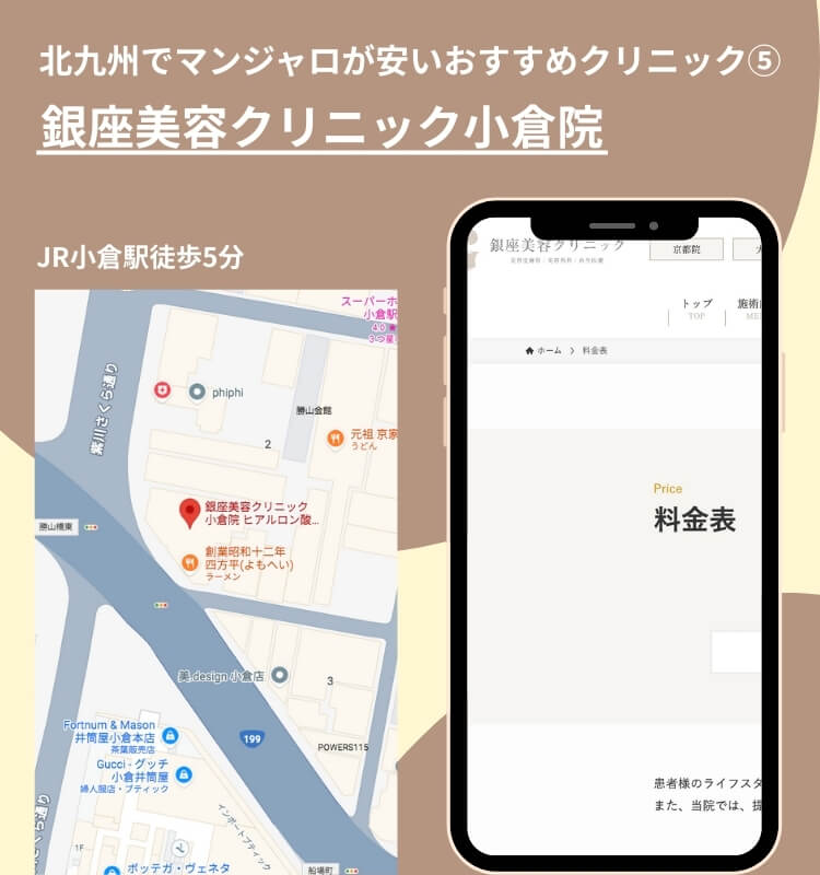 北九州でマンジャロが安いおすすめクリニック④銀座美容クリニック小倉院