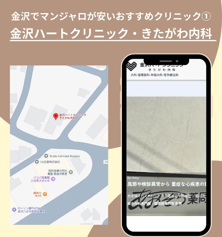 金沢でマンジャロが安いおすすめクリニック①金沢ハートクリニック・きたがわ内科