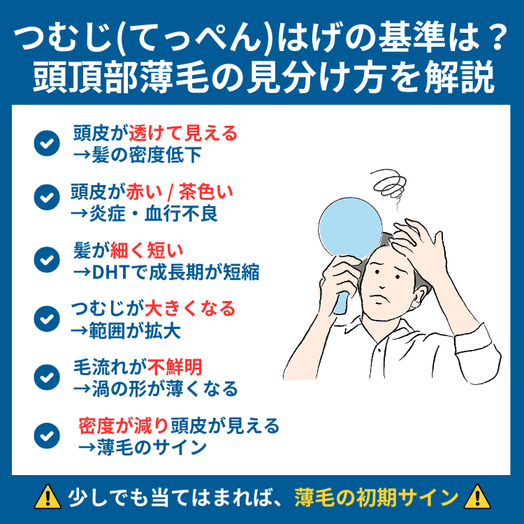 つむじはげの基準