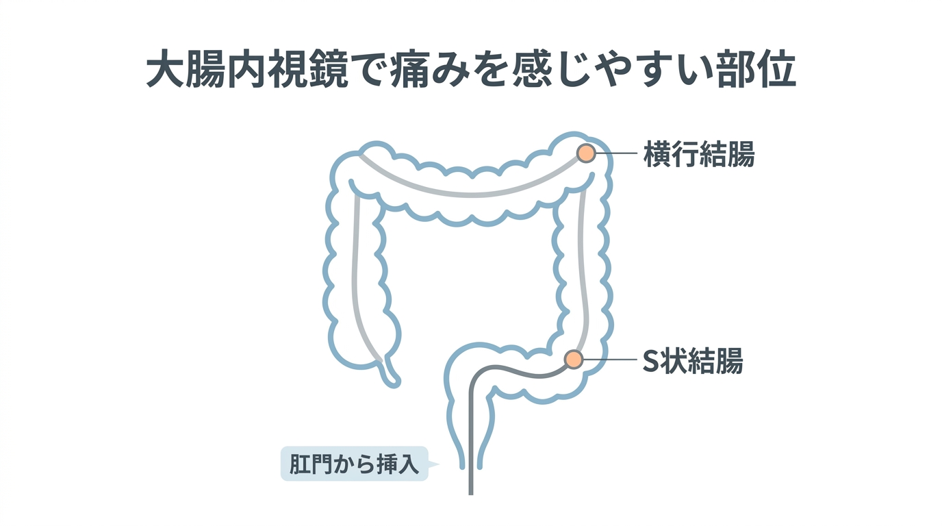 内視鏡検査は痛い？胃カメラ・大腸カメラの痛みの原因と抑える方法を解説の解説画像