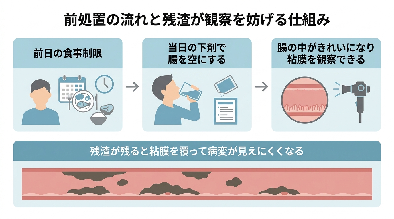 大腸内視鏡検査の前日に食べてしまった時の対処法と検査への影響を解説の解説画像
